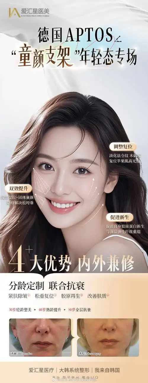 索菲亚seo效果怎么样？ 做优化该注意哪些事？