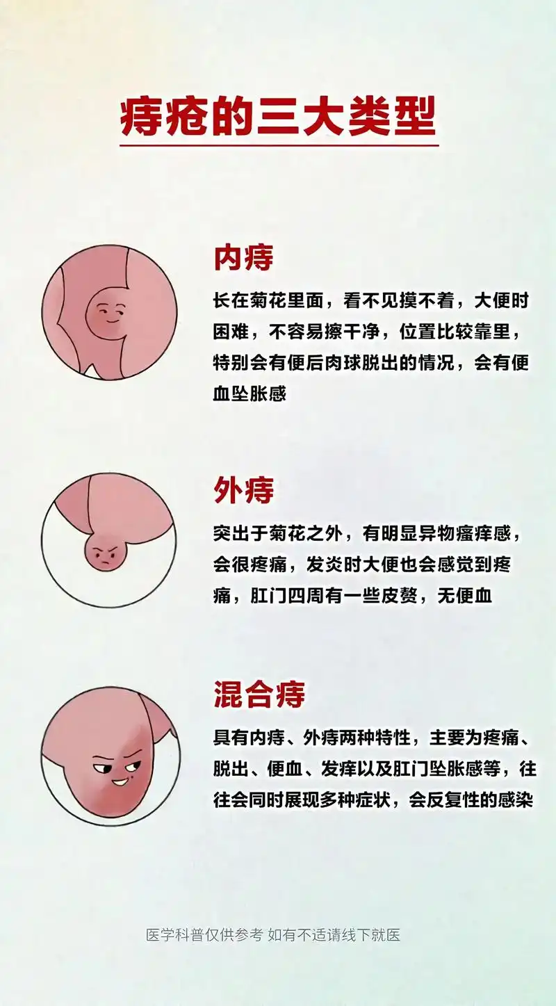 SEO为什么总被问到'为什么会长痔疮'这类问题？