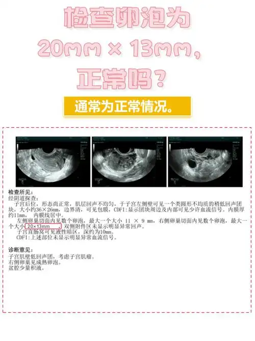 卵泡萎缩如何准确监测？哪些信号提示需要干预？