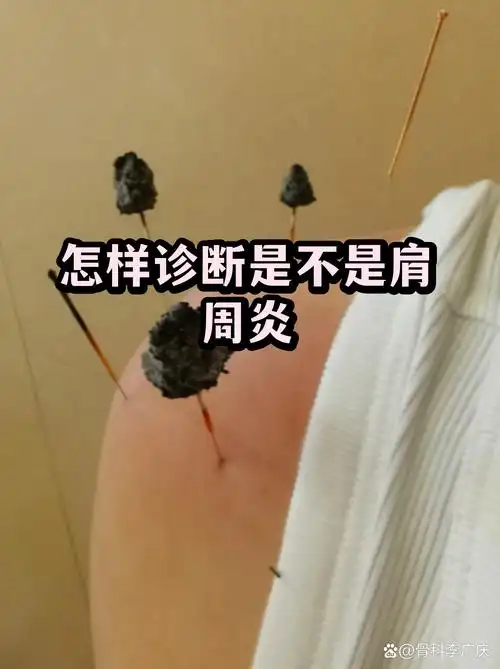 豆豆SEO真的有效吗？ 如何判断它是否适合你的网站？